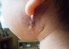 surgery3.JPG